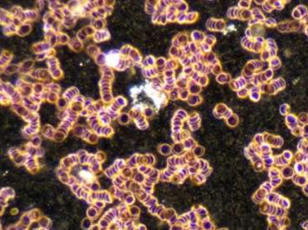 geldrollenbildung-frau-85-jahre.png?ts=1765185009